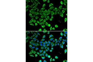 Immunofluorescence analysis of A-549 cells using Lipocalin-2/NGAL antibody (ABIN6128177, ABIN6143114, ABIN6143115 and ABIN6215076). (Lipocalin 2 Antikörper)