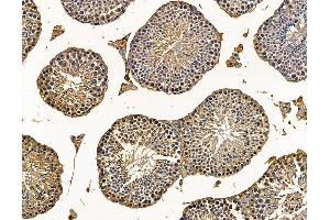 ABIN7095739 and ABIN7099801 at 1/100 staining mouse testis tissue by IHC-P. (MGAT5 Antikörper)