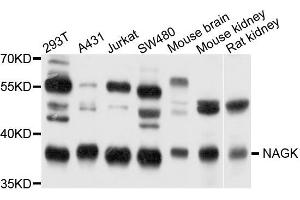 Western blot analysis of extract of various cells, using NAGK antibody. (NAGK Antikörper)