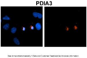 Sample Type: NT2 cells Red: Antibody Blue: DAPI Primary Dilution: 1ug/50ul antibody Secondary Antibody: Alexa goat anti-rabbit 594 Image Submitted by: Yuzhi Chen, University of Arkansas for Medical Sciences (PDIA3 Antikörper  (C-Term))