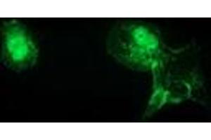 Anti-CTNNB1 mouse monoclonal antibody (ABIN2454136) immunofluorescent staining of COS7 cells transiently transfected by pCMV6-ENTRY CTNNB1 (RC208947). (CTNNB1 Antikörper)