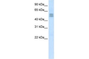 Western Blotting (WB) image for anti-LIM Homeobox Transcription Factor 1, beta (LMX1B) antibody (ABIN2461655) (LMX1B Antikörper)
