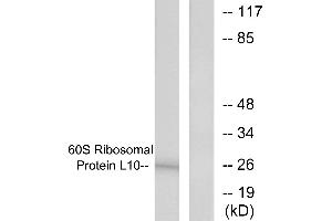 Western blot analysis of extracts from K562 cells, treated with Insulin (0. (RPL10 Antikörper  (Internal Region))