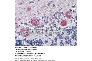 Immunohistochemistry (IHC) image for anti-Grainyhead-Like 2 (GRHL2) (Middle Region) antibody (ABIN2778358) (GRHL2 Antikörper  (Middle Region))