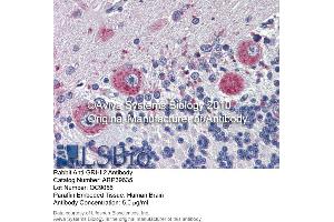 Immunohistochemistry (IHC) image for anti-Grainyhead-Like 2 (GRHL2) (Middle Region) antibody (ABIN405258) (GRHL2 Antikörper  (Middle Region))