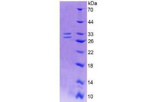 Image no. 1 for Nerve Growth Factor (NGF) (AA 19-239) (Active) protein (His tag) (ABIN6239732)