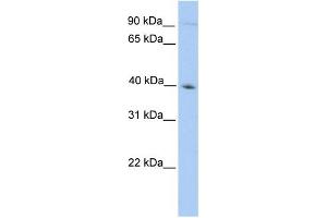 WB Suggested Anti-ODF2 Antibody Titration: 0. (ODF2 Antikörper  (N-Term))