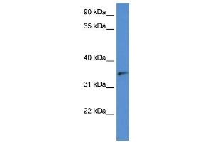 Western Blot showing SORD antibody used at a concentration of 1 ug/ml against Hela Cell Lysate (SORD Antikörper  (N-Term))