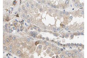 ABIN6268747 at 1/100 staining human kidney tissue sections by IHC-P.