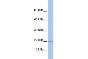 WB Suggested Anti-MPV17L Antibody Titration: 0. (MPV17L Antikörper  (N-Term))
