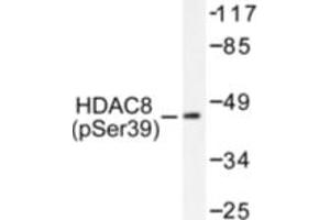 Image no. 1 for anti-Histone Deacetylase 8 (HDAC8) (pSer39) antibody (ABIN318034)