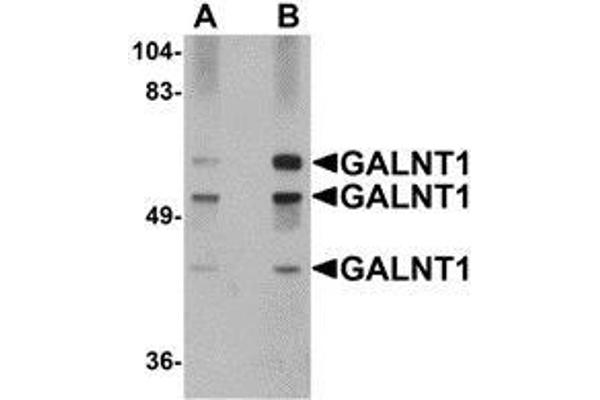 GALNT10 antibody  (N-Term)