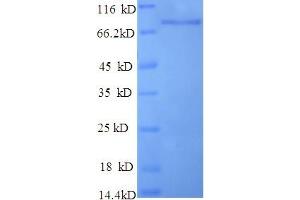 SDS-PAGE (SDS) image for Poly A Specific Ribonuclease (PARN) (AA 1-639), (full length) protein (His tag) (ABIN4975880)