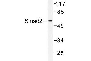 Image no. 1 for anti-SMAD, Mothers Against DPP Homolog 2 (SMAD2) antibody (ABIN271912) (SMAD2 Antikörper)