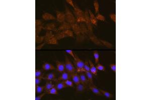 Immunofluorescence analysis of NIH-3T3 cells using OSBP Rabbit pAb (ABIN1681171, ABIN3018393, ABIN3018394 and ABIN6220458) at dilution of 1:100 (40x lens). (OSBP Antikörper  (AA 508-807))