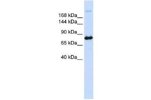 CAD antibody used at 1 ug/ml to detect target protein. (CAD Antikörper  (N-Term))