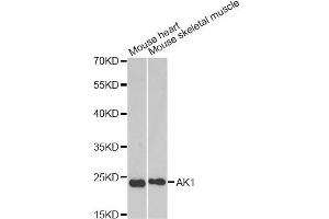 Western blot analysis of extracts of various cell lines, using AK1 antibody. (Adenylate Kinase 1 Antikörper)