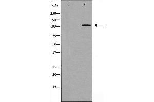 Western blot analysis of EPHB4 expression in 293 cell extract,The lane on the left is treated with the antigen-specific peptide. (EPH Receptor B4 Antikörper  (Internal Region))