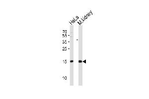 Western blot analysis of lysates from HeLa cell line, mouse kidney tissue lysate (from left to right), using CDA Antibody (C-term) (ABIN389393 and ABIN2839485).