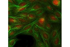 IF analysis of RBP1 using anti-RBP1 antibody (ABIN7599586) and anti-Tubulin Alpha antibody (ABIN7600339). (RBP1 Antikörper  (AA 10-135))