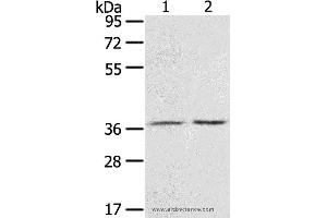 Western blot analysis of Mouse stomach tissue and A431 cell, using PDLIM4 Polyclonal Antibody at dilution of 1:800 (PDLIM4 Antikörper)