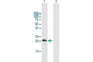 Western Blot analysis of RGS10 expression in transfected 293T cell line by RGS10 MaxPab polyclonal antibody. (RGS10 Antikörper  (AA 1-181))