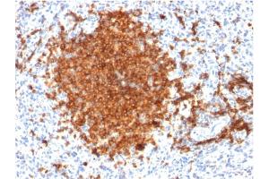 Immunohistochemistry (IHC) image for anti-CD22 Molecule (CD22) (AA 52-178) antibody (ABIN6941120)