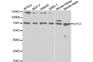 Western blot analysis of extracts of various cell lines, using GPC3 antibody (ABIN5971006) at 1/1000 dilution. (Glypican 3 Antikörper)
