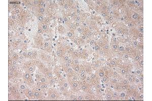 Immunohistochemical staining of paraffin-embedded liver tissue using anti-PROM2mouse monoclonal antibody. (Prominin 2 Antikörper)