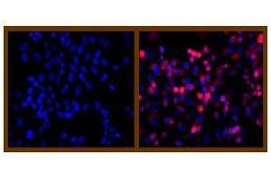Immunofluorescence (IF) image for anti-His Tag antibody (ABIN126947) (His Tag Antikörper)