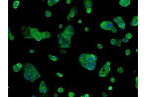 Immunofluorescence (IF) image for anti-Sorbitol Dehydrogenase (SORD) antibody (ABIN1501072)