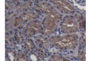 Immunohistochemistry (IHC) image for anti-Fatty Acid Binding Protein 1, Liver (FABP1) (AA 1-127) antibody (ABIN1862467)