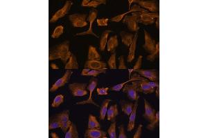 Immunofluorescence analysis of U-2 OS cells using MTMR4 Polyclonal Antibody (ABIN7268764) at dilution of 1:100 (40x lens). (MTMR4 Antikörper  (AA 920-1195))