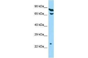 Host: Rabbit Target Name: THOC7 Sample Type: HepG2 Whole Cell lysates Antibody Dilution: 1. (THOC7 Antikörper  (C-Term))