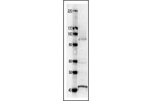 Western Blotting (WB) image for anti-Ribonucleoside Reductase Large Subunit Cdc22 (CDC22) antibody (ABIN2451937)