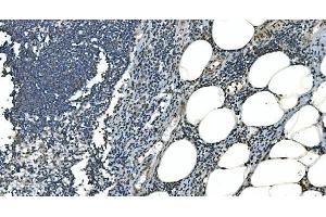 IHC analysis of LSM8 using anti-LSM8 antibody (ABIN7599579). (NAA38 Antikörper  (AA 1-96))