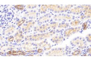 Immunohistochemistry (IHC) image for anti-Keratin 13 (KRT13) (AA 104-403) antibody (ABIN7434251)