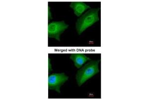 ICC/IF Image Immunofluorescence analysis of paraformaldehyde-fixed HeLa, using Annexin A1, antibody at 1:200 dilution. (Annexin a1 Antikörper)