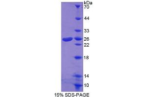 Image no. 1 for ATP-Binding Cassette, Sub-Family A (ABC1), Member 8 (ABCA8) (AA 1263-1456) protein (T7 tag,His tag) (ABIN6239304) (ABCA8 Protein (AA 1263-1456) (T7 tag,His tag))