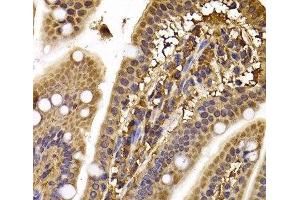 Immunohistochemistry of paraffin-embedded Mouse ileum using CLASP1 Polyclonal Antibody at dilution of 1:100 (40x lens). (CLASP1 Antikörper)