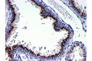 Image no. 2 for anti-Golgi Membrane Protein 1 (GOLM1) antibody (ABIN1498494) (GOLM1 Antikörper)