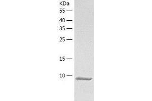 DPH3, KTI11 Homolog (S. Cerevisiae) Pseudogene 1 (DPH3P1) (AA 1-78) protein (His-IF2DI Tag)