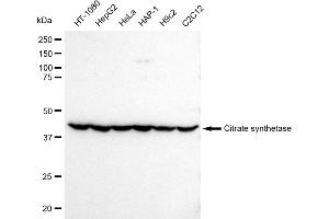 Western blotting analysis using Citrate synthetase antibody (ABIN7798088). (Rekombinanter Citrate Synthetase Antikörper)