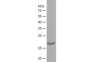 COL15A1 Protein (AA 1212-1388) (His tag)