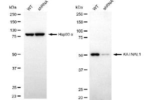 Western blotting analysis using KATNAL1 antibody (ABIN7799159). (KATNAL1 Antikörper)
