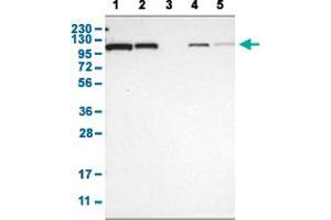 Western Blot analysis with HSPA4 polyclonal antibody . (HSPA4 Antikörper  (AA 699-808))
