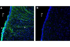 Expression of GPR142 in rat ventromedial hypothalamus. (G Protein-Coupled Receptor 142 (GPR142) Peptid)