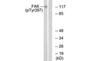 Western blot analysis of extracts from Jurkat cells treated with Ca2+ 40nM 30', using FAK (Phospho-Tyr397) Antibody. (FAK Antikörper  (pTyr397))