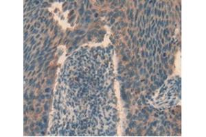 Immunohistochemistry (IHC) image for anti-T Cell Immunoreceptor with Ig and ITIM Domains (TIGIT) (AA 21-234) antibody (ABIN7439486)