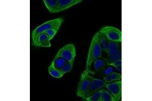 Immunofluorescence analysis of MCF-7 cells using RELB mouse mAb (green). (RELB Antikörper  (AA 273-443))
